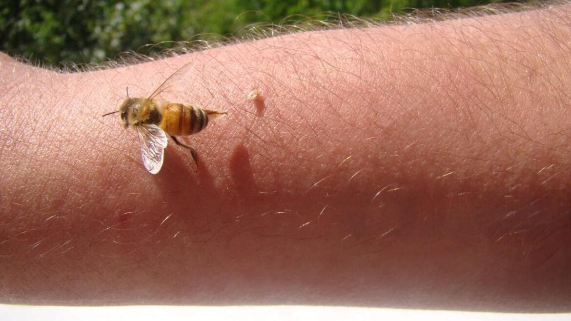 Bee Venom Exploring Its Complex Chemistry and Medical Potential